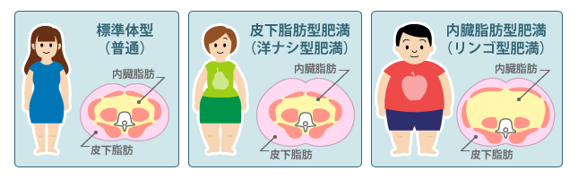 皮下脂肪型肥満（洋ナシ）内臓脂肪肥満（りんご型）の断面