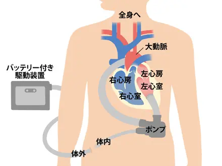 心不全のメカニズム