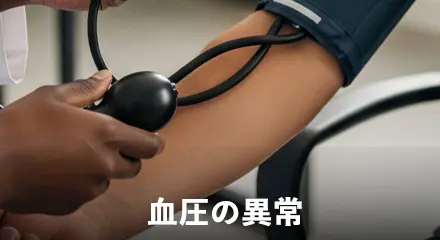 高血圧（血圧の異常）を放置した場合
